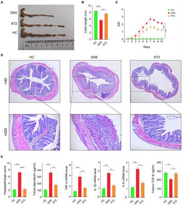 Alterations in metabolome and microbiome signatures provide clues to the role of antimicrobial peptide KT2 in ulcerative colitis